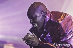 Skunk Anansie